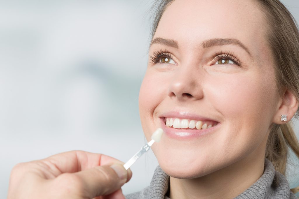 Dental Veneers - Advanced Healthcare Dental Centre